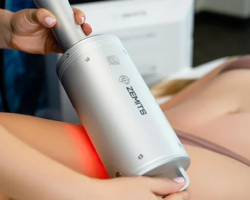 Cavitation + Roller Spheres