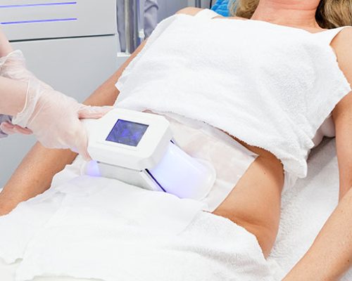 Cryo Slimming or Cryo Toning