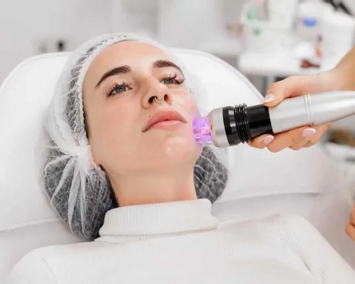 Derma - Needling & Collagen Boosting