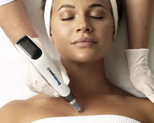 Derma - needling Décolletage