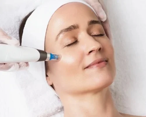 Derma - needling (Face or Neck)