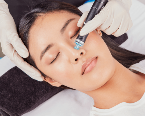 Hydropeel Fusion Treatment